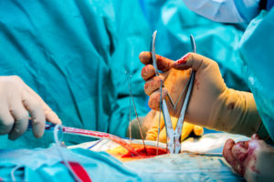 lumbar surgery