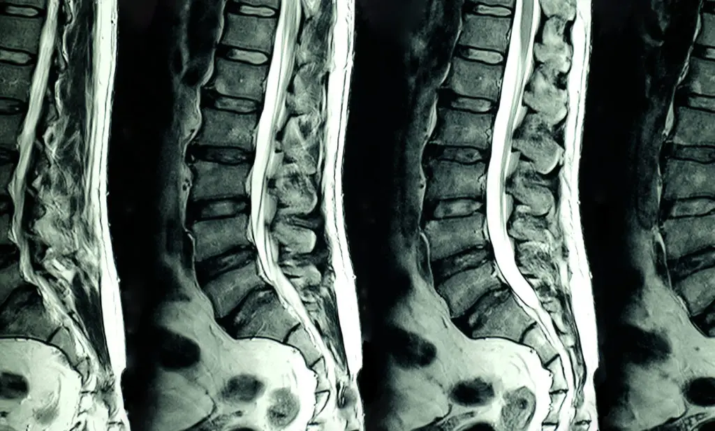 medical imaging to clarify the diagnosis of back pain