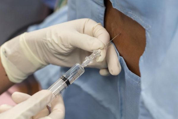 Vertebroplastia: Uma solução após fratura vertebral | Lombafit