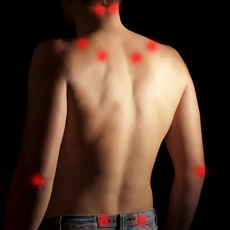 Fibromyalgie und Rückenschmerzen