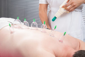 cupping cups to relieve back pain quickly