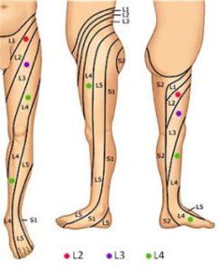 dermatomer