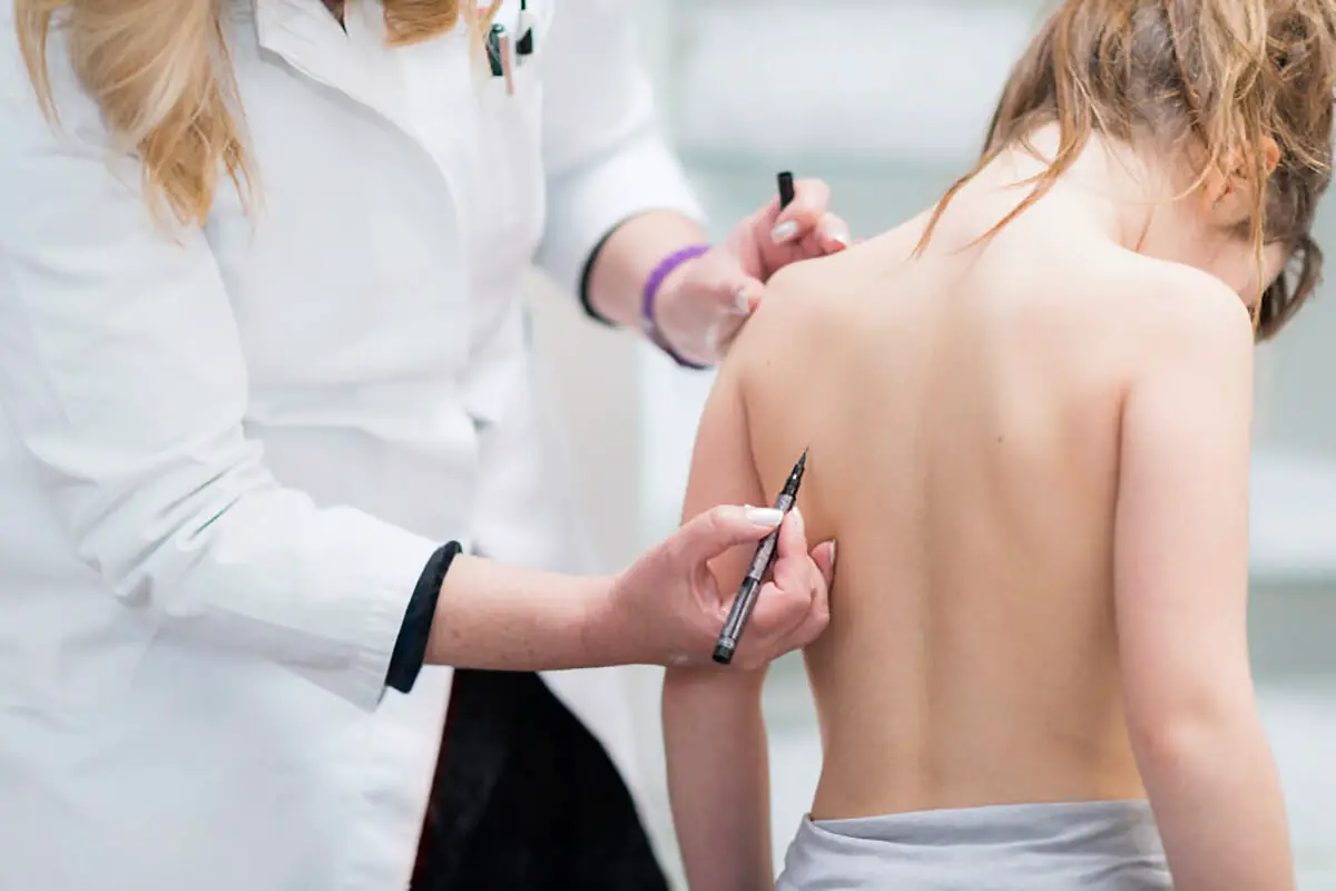 skoliose medicinsk vurdering