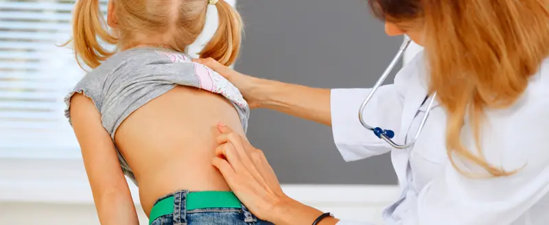 scoliose evaluation medicale