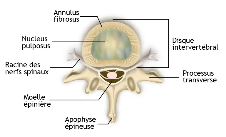 anatomie du disque intervertébral incluant le noyau et l'anneau fibreux pour comprendre la hernie discale