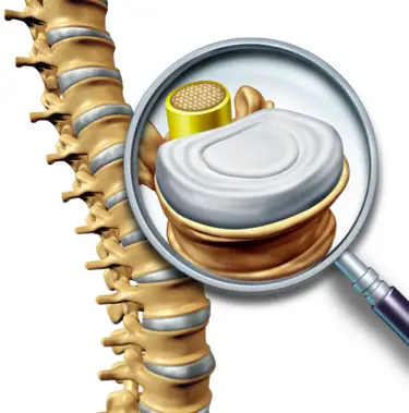 anatomía de los discos intervertebrales y la columna vertebral