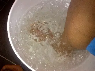 bain de glace pour diminuer l'inflammation