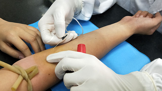 blodprøver for at afklare diagnosen lænderygsmerter