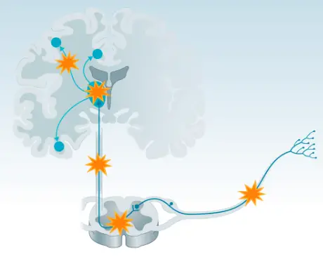 desensibilización causada por la modulación del cerebro