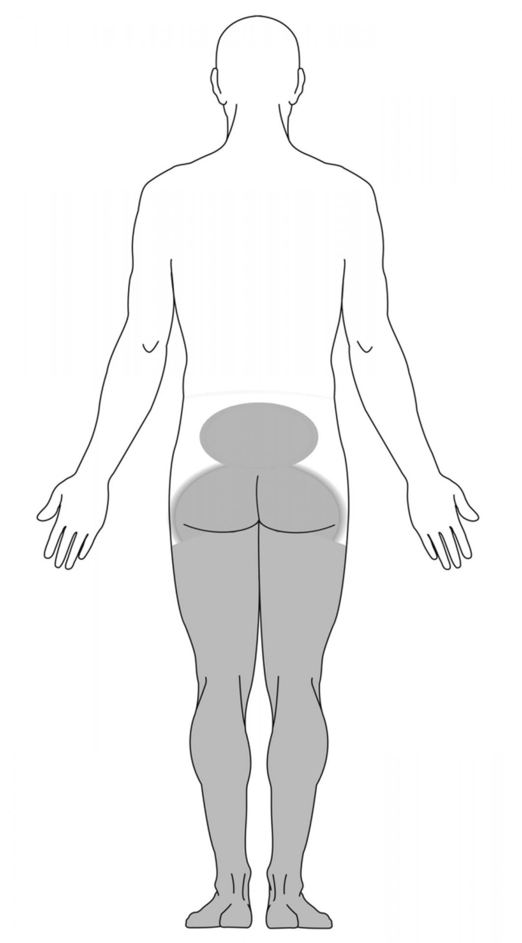 sintomas nas pernas devido à síndrome da cauda equina