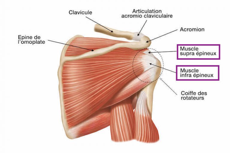 Cetosis ganar musculo