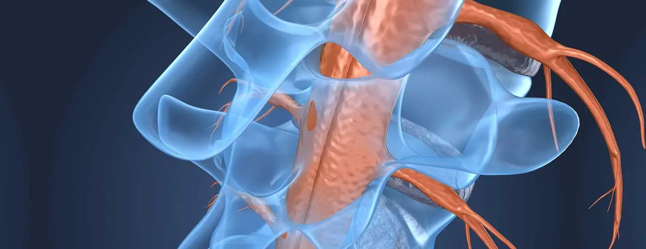 Rückenmarkskrebs: Typen und Prognose