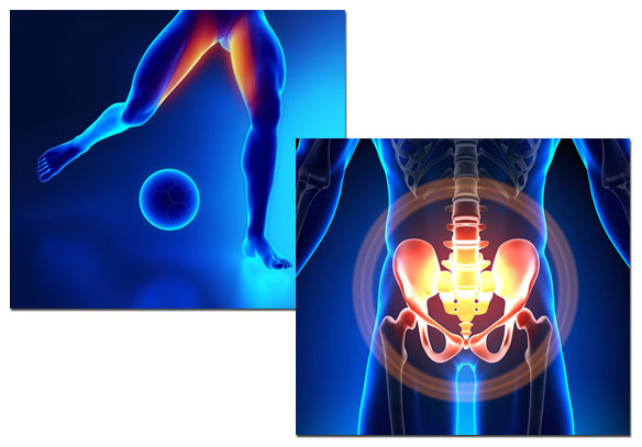 pubalgia causing hip pain