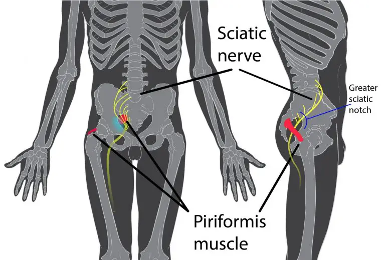 Syndrome du pyramidal Causes et traitements