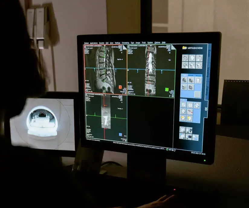 sektioner af en lumbalscanning