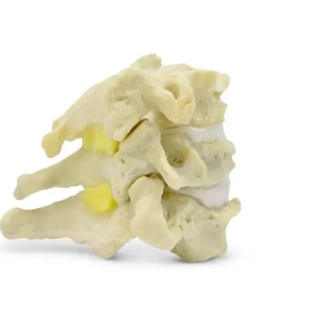 Gelbes Band: Definition und Anatomie (Verbindung mit Rückenschmerzen)