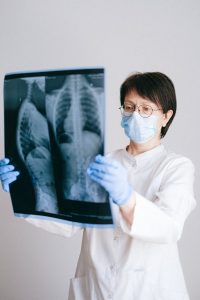 肋骨の医用画像を分析する医師