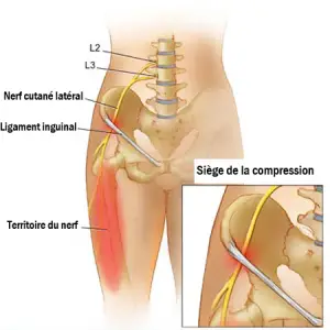 lateral femorokutan nerve