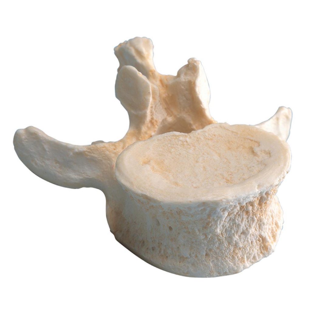 vertebral kropp