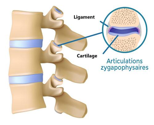 zygapophyseal led