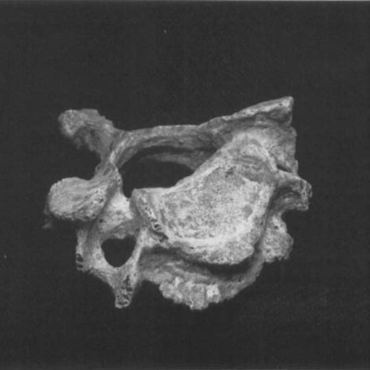 lábio vertebral