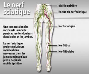 course of the sciatic nerve