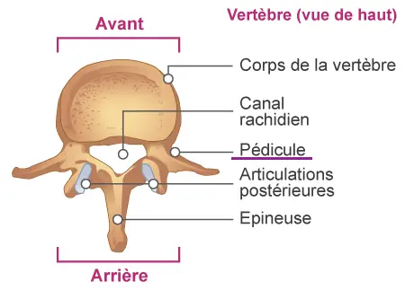 vertebral pedikel