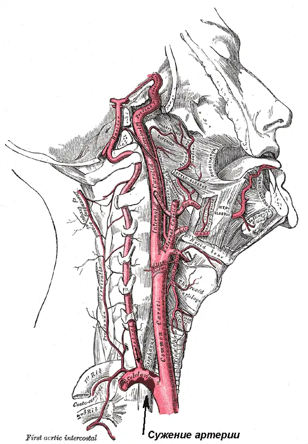 vertebral arterie