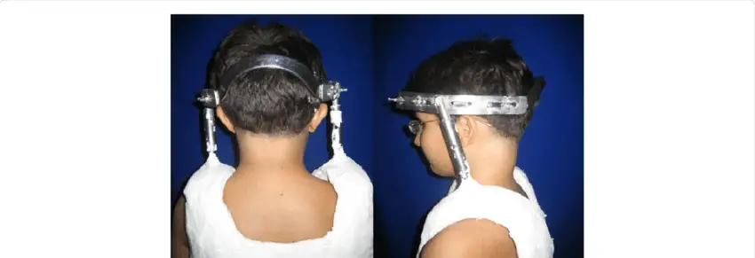 zervikaler Halo