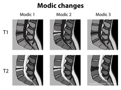 modisk tegn