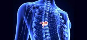 back hernia