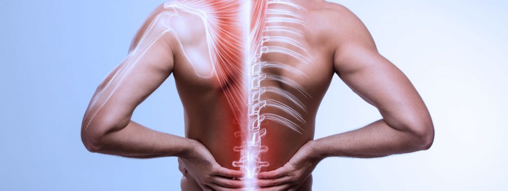 lançar luz sobre desarranjo intervertebral menor desarranjo intervertebral menor