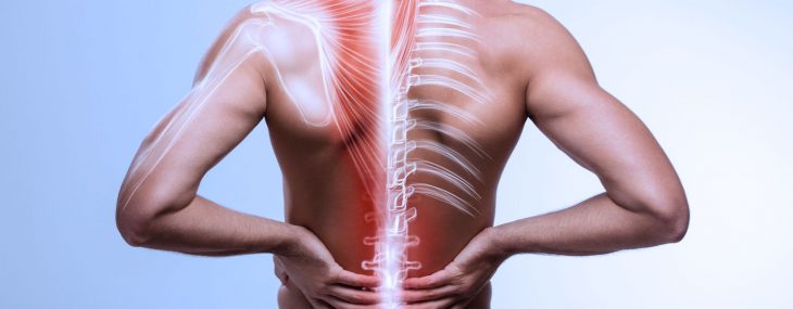 Dérangement intervertébral mineur : Cause de douleur au dos