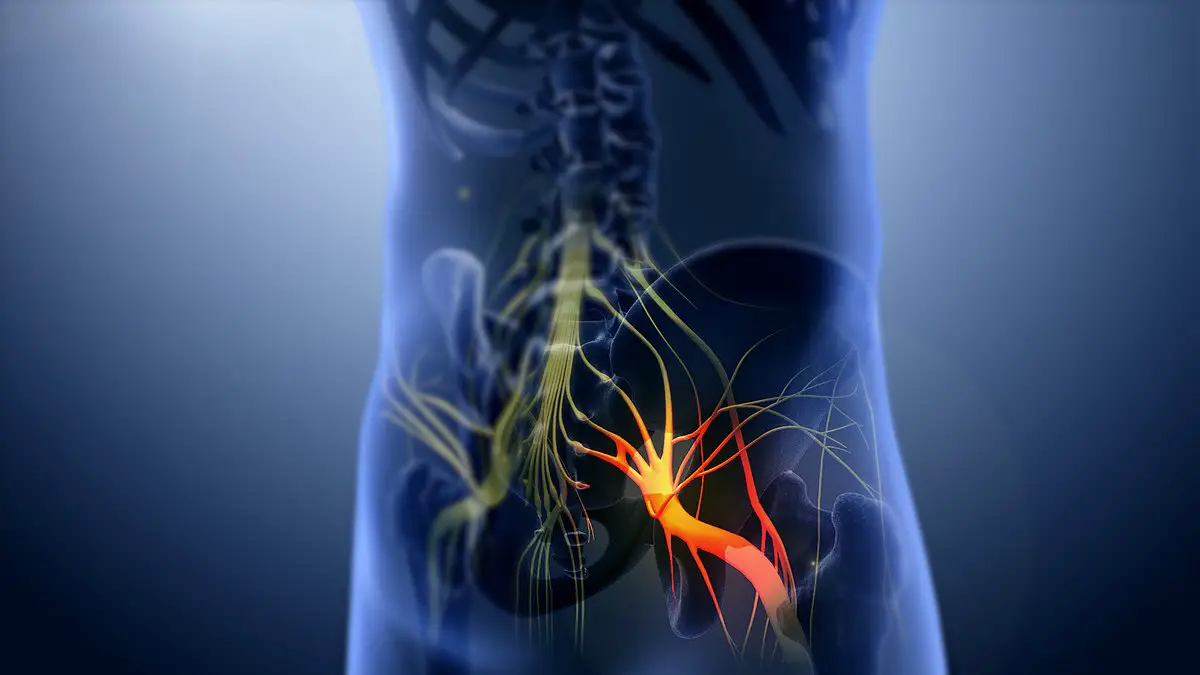 nerve sciatic: Anatomy agus cùrsa (pathologies co-cheangailte)