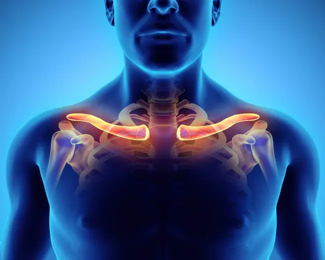 Thoracic-outlet-Syndrom