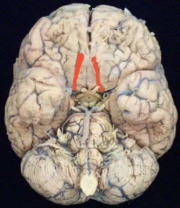 kraniale nerver2 serratus anterior muskel