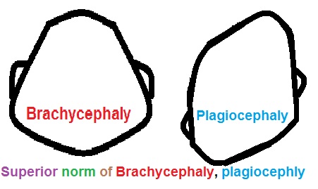 comparação entre braquicefalia e plagiocefalia
