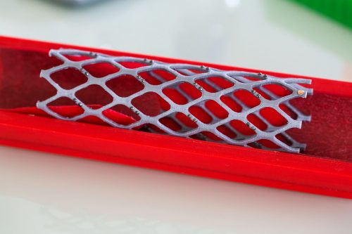 col·locació d'un stent