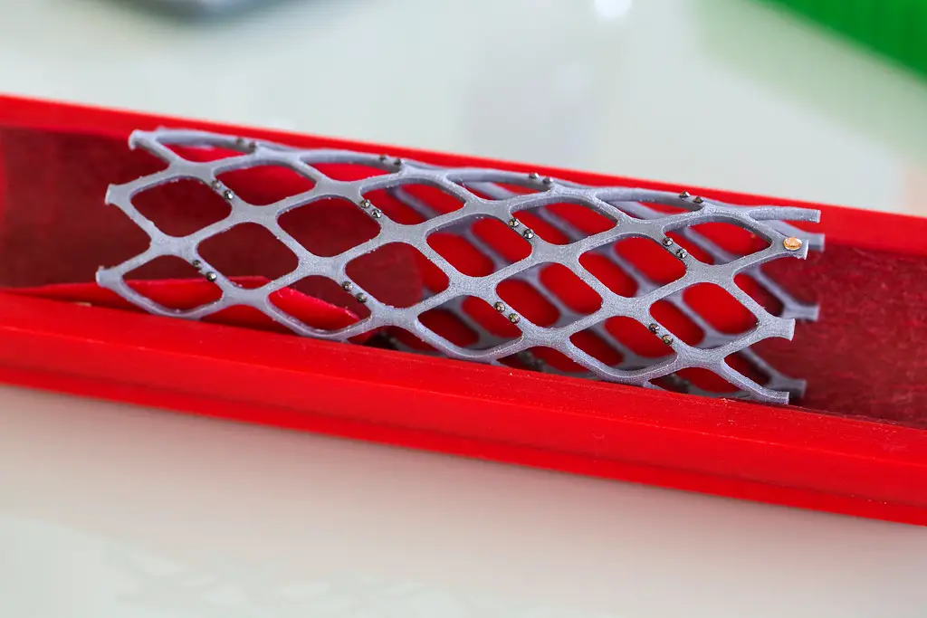Interkostalschmerzen nach Stent-Platzierung: Erklärungen (ist es ernst?)