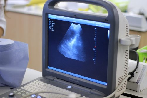 ultrassom na gravidez