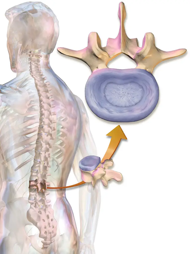 anatomi af den intervertebrale disk