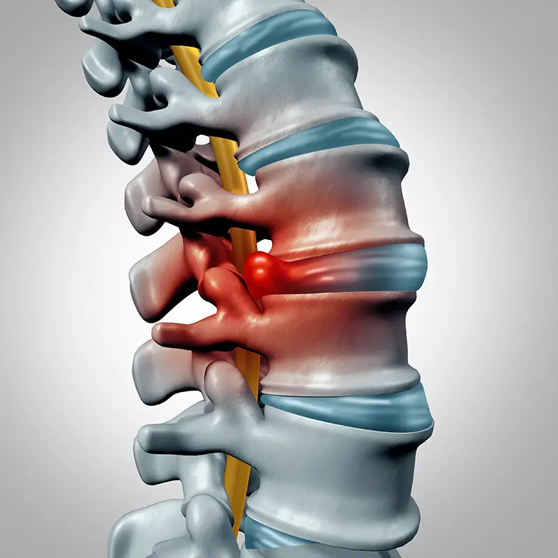 lumbar