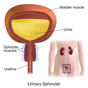 Urin sphincter iskias og vandladningstrang