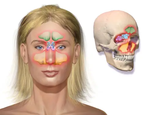 Sinus Cervikal arthritis og bihulebetændelse